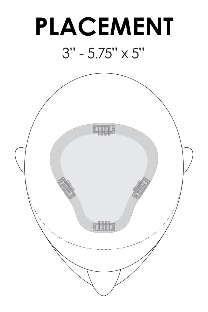 EasiPart XL Placement